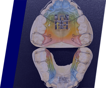 取り扱い技工物